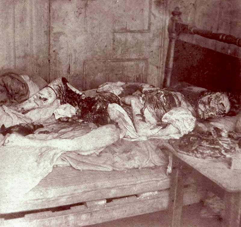 Jack the Ripper Victim